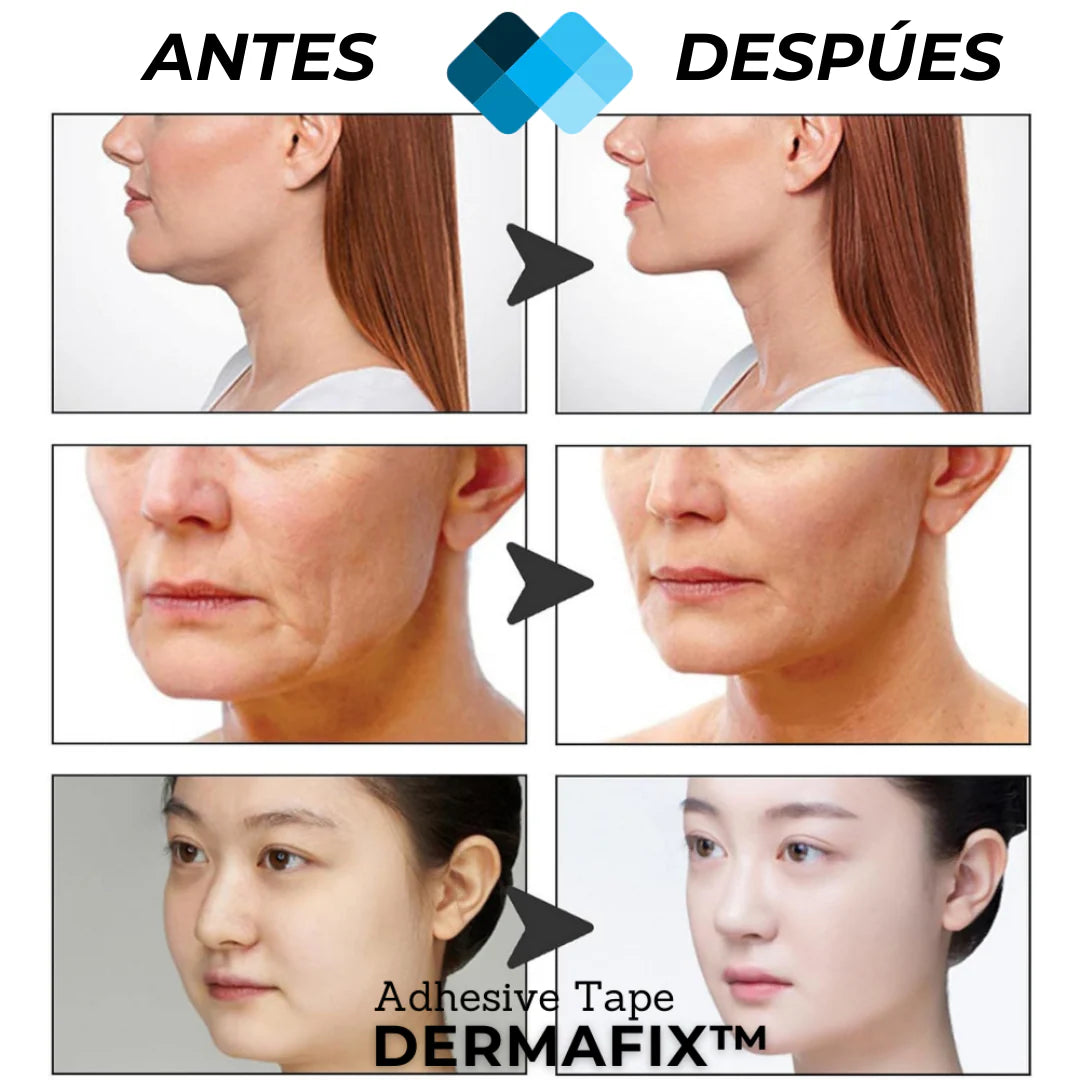 💎Tiras Lifting (120)– Rejuvenece tu rostro sin gastar de más